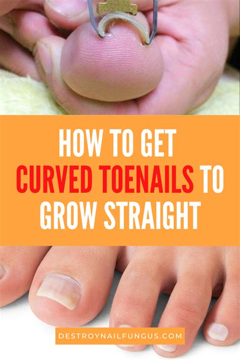 how do toenails grow diagram